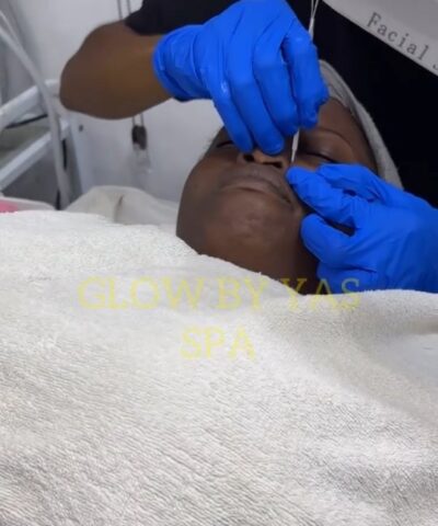 Corrective Acne Facial